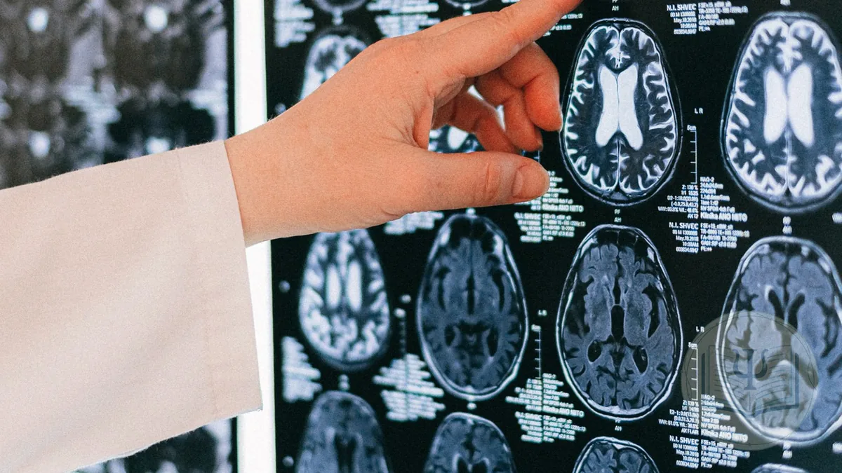 Neuropsicólogo señalando una imagen cerebral durante una evaluación neuropsicológica